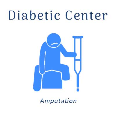 Nobile Shoes Diabetic Center treats amputation