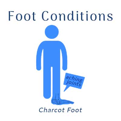 Nobile Shoes treats foot conditions such as charcot foot