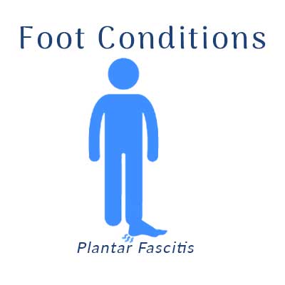 Nobile Shoes treats with Plantar Fascitis